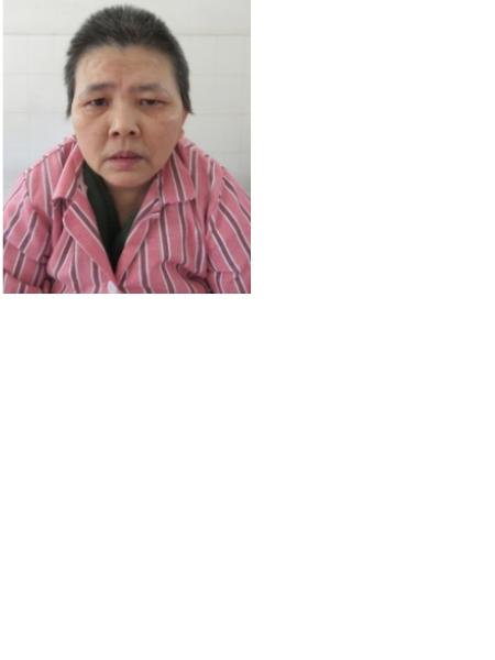 失踪人员尤秋萍照片，让爱回家