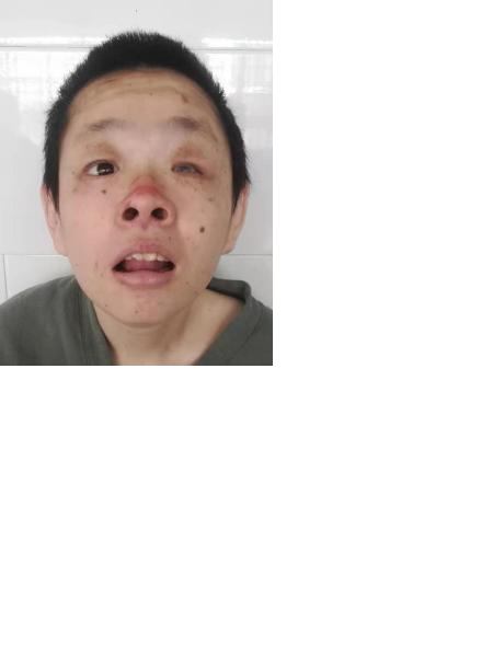失踪人员白丽婷照片，让爱回家