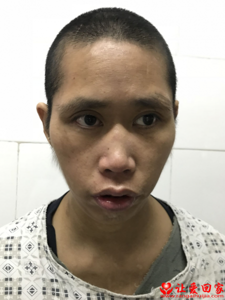 失踪人员卢应伟照片，让爱回家