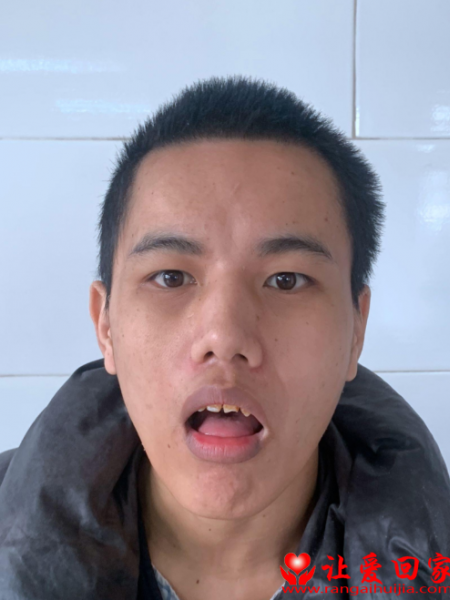 失踪人员卢雄星照片，让爱回家