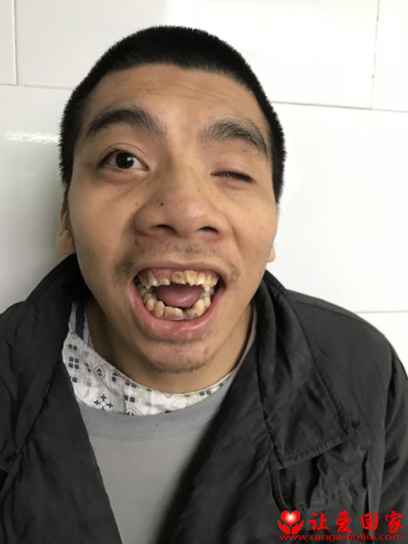失踪人员卢勇伟照片，让爱回家